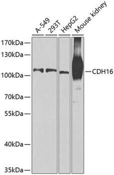 Anti-CDH16 Antibody (CAB7882)