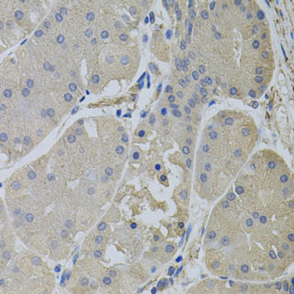 Anti-CLTC Antibody (CAB7886)