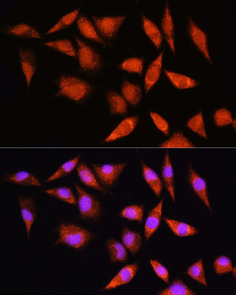Anti-HSPA2 Antibody (CAB7902)