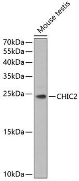 Anti-CHIC2 Antibody (CAB7971)