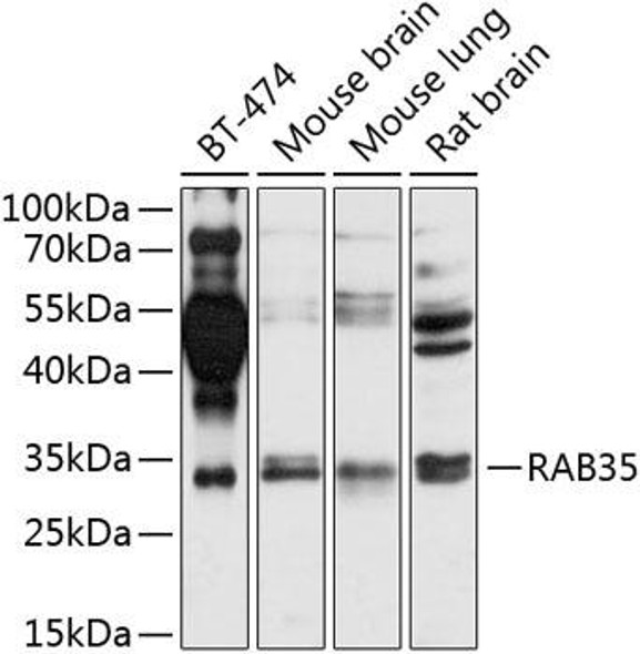 Anti-RAB35 Antibody (CAB8030)