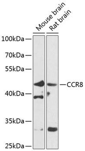 Anti-CCR8 Antibody (CAB8048)