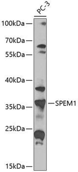 Anti-SPEM1 Antibody (CAB8076)