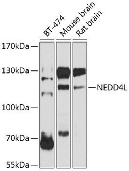 Anti-NEDD4L Antibody (CAB8085)