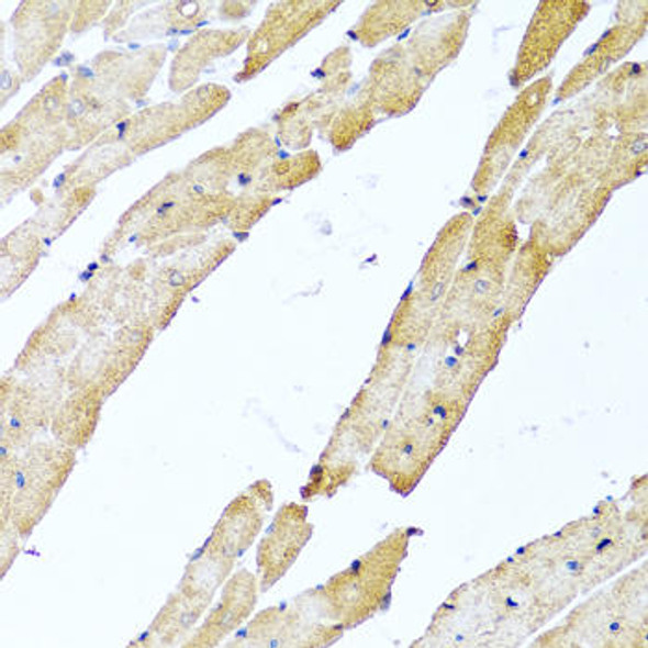 Anti-CALCB Antibody (CAB8105)