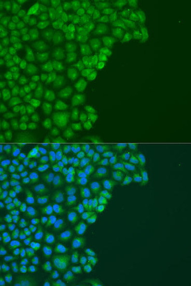 Anti-DAPK2 Antibody (CAB8199)