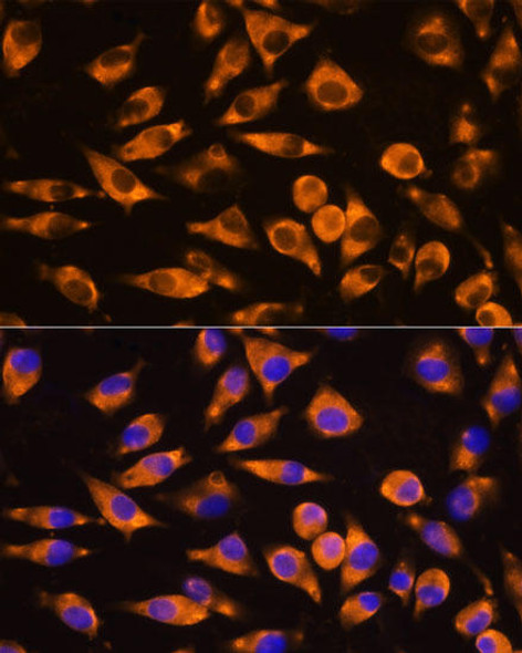 Anti-CEP55 Antibody (CAB8229)