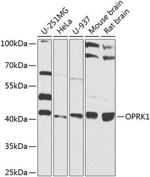 Anti-OPRK1 Antibody (CAB8306)