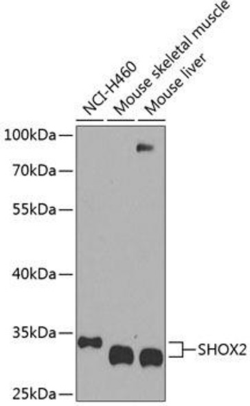 Anti-SHOX2 Antibody (CAB8309)