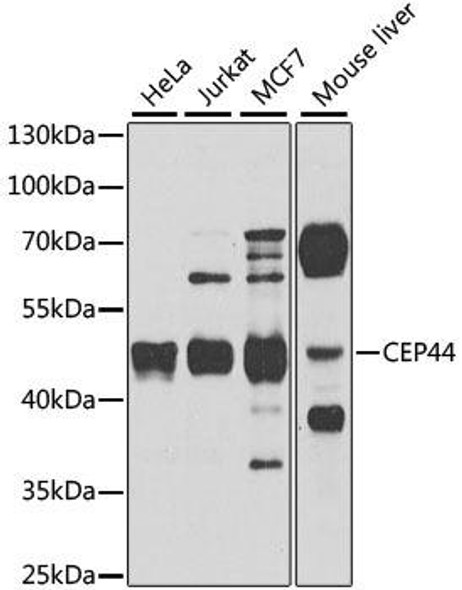 Anti-CEP44 Antibody (CAB8317)