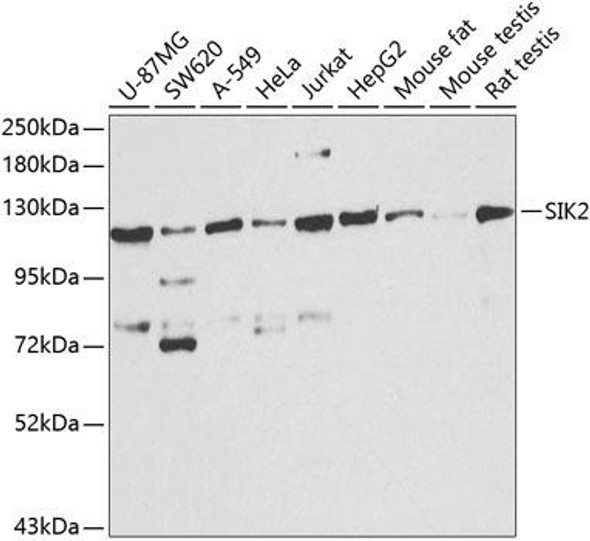 Anti-SIK2 Antibody (CAB8321)