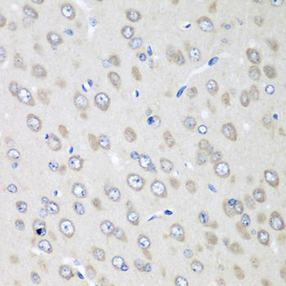 Anti-RPN2 Antibody (CAB8352)