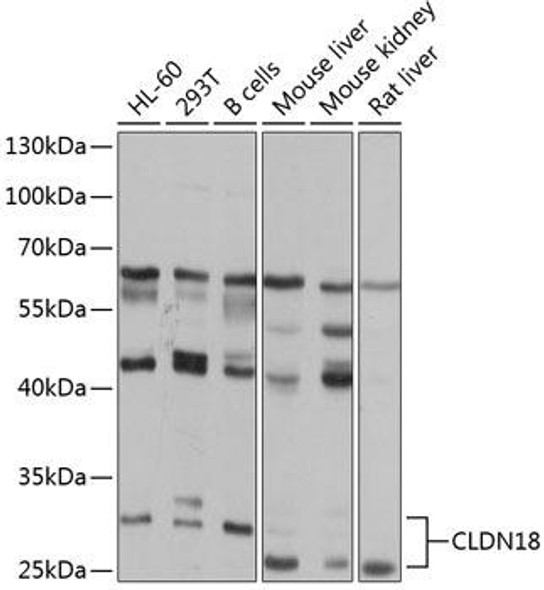 Anti-Claudin-18 Antibody (CAB8392)