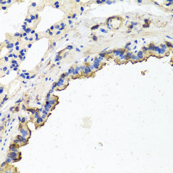 Anti-TUBB8 Antibody (CAB8396)