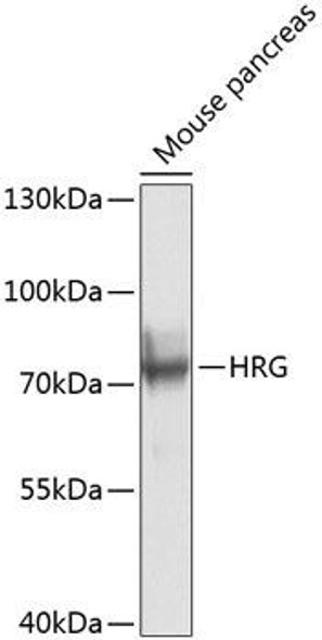 Anti-HRG Antibody (CAB8431)