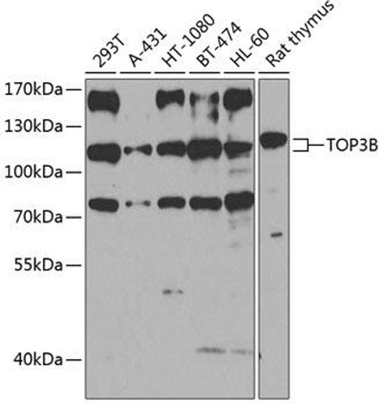 Anti-TOP3B Antibody (CAB8469)
