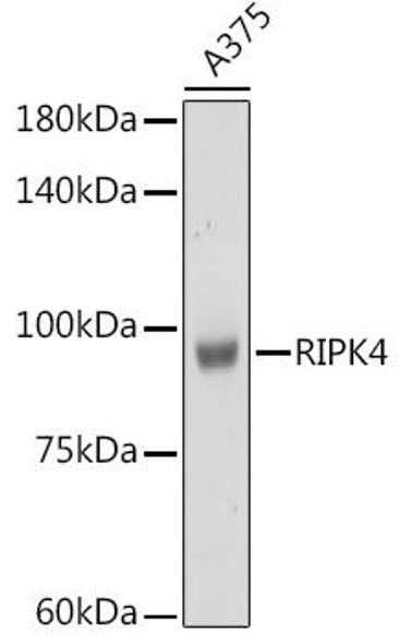 Anti-RIPK4 Antibody (CAB8495)
