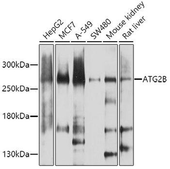 Anti-ATG2B Antibody (CAB8498)