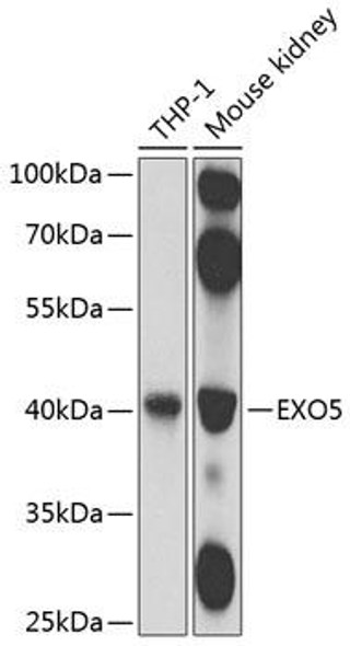Anti-Exonuclease V Antibody (CAB8507)