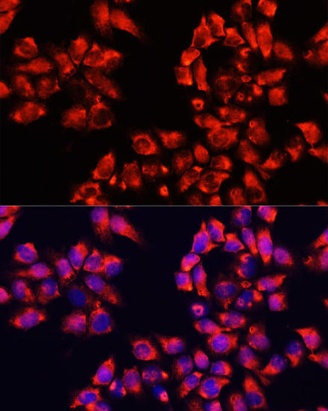 Anti-ALDH7A1 Antibody (CAB8629)