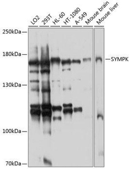 Anti-Symplekin Antibody (CAB8722)