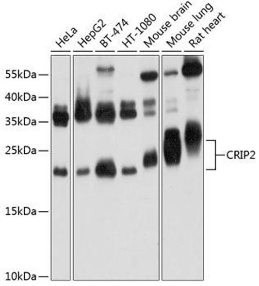 Anti-CRIP2 Antibody (CAB9038)