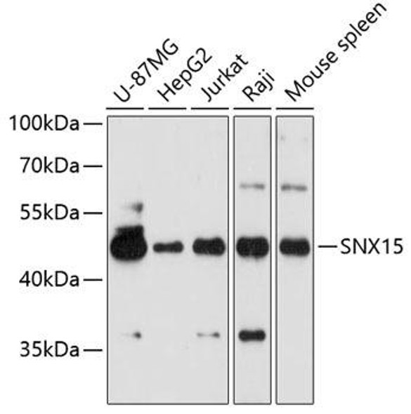 Anti-SNX15 Antibody (CAB9158)