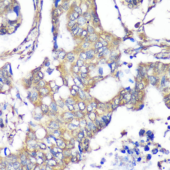 Anti-TXNDC9 Antibody (CAB9676)