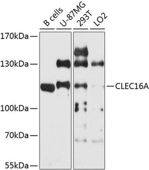 Anti-Protein CLEC16A Antibody (CAB9753)