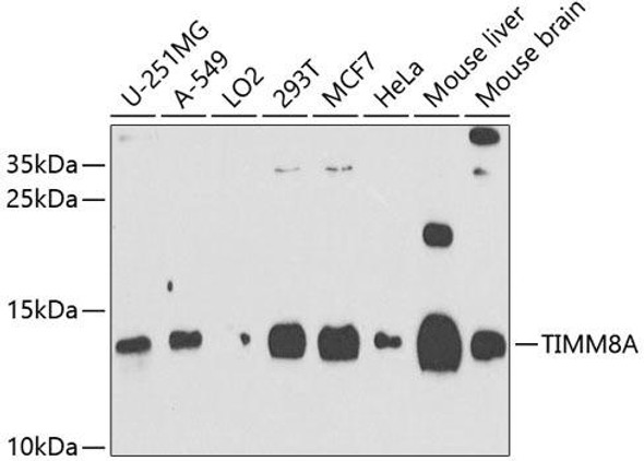 Anti-TIMM8A Antibody (CAB9811)