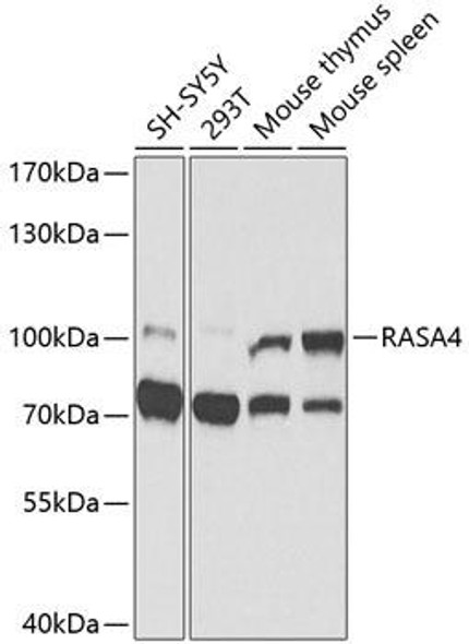 Anti-RASA4 Antibody (CAB9860)