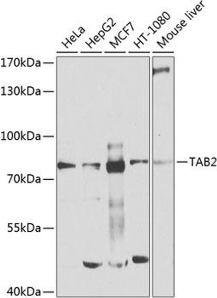 Anti-TAB2 Antibody (CAB9867)