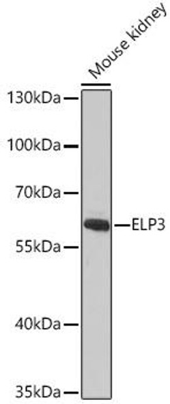 Anti-ELP3 Antibody (CAB9877)