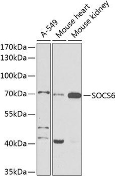 Anti-SOCS6 Antibody (CAB9957)