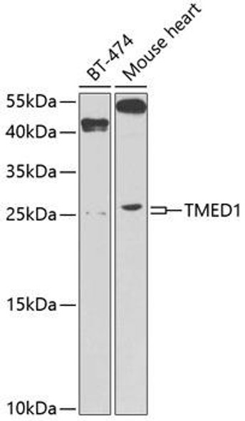 Anti-TMED1 Antibody (CAB9963)