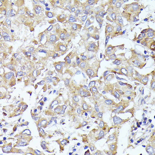 Anti-EIF3L Antibody (CAB9972)