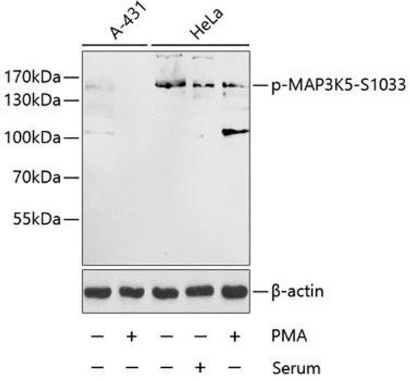 Anti-Phospho-MAP3K5-S1033 Antibody (CABP0058)