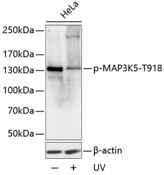 Anti-Phospho-MAP3K5-T918 Antibody (CABP0061)