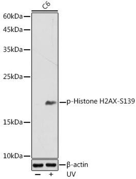 Anti-Phospho-Histone H2AFX-S139 Antibody (CABP0099)