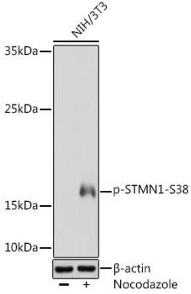Anti-Phospho-Stathmin-S38 Antibody (CABP0221)