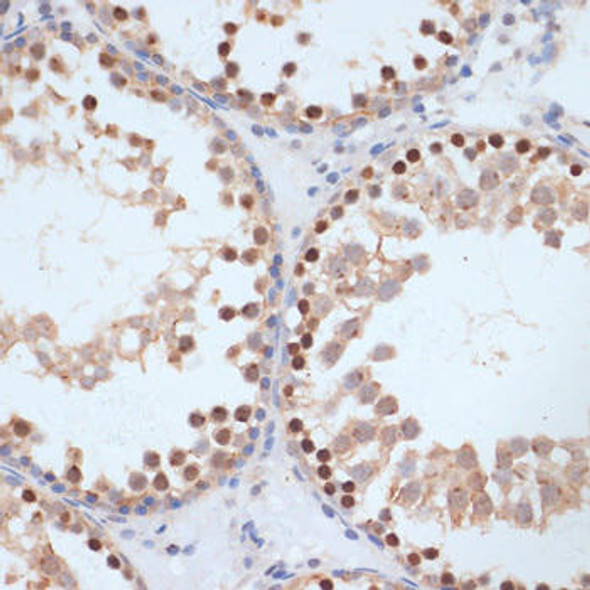 Anti-Phospho-BRCA1-S1423 Antibody (CABP0232)