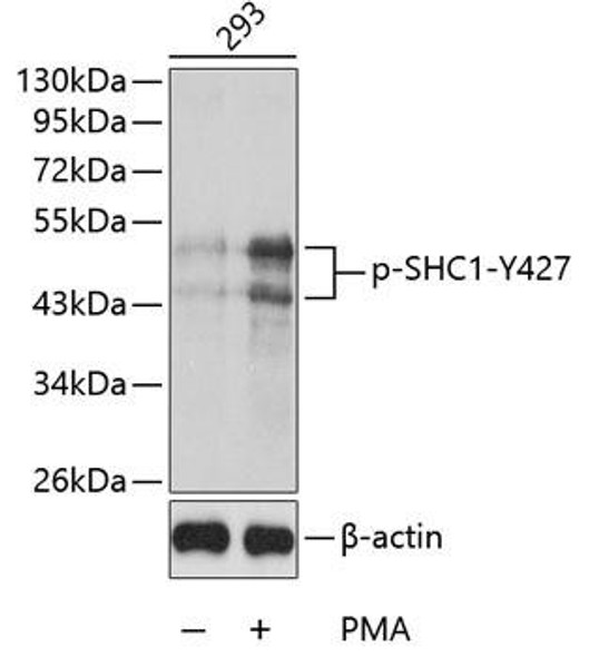 Anti-Phospho-SHC1-Y427 Antibody (CABP0266)