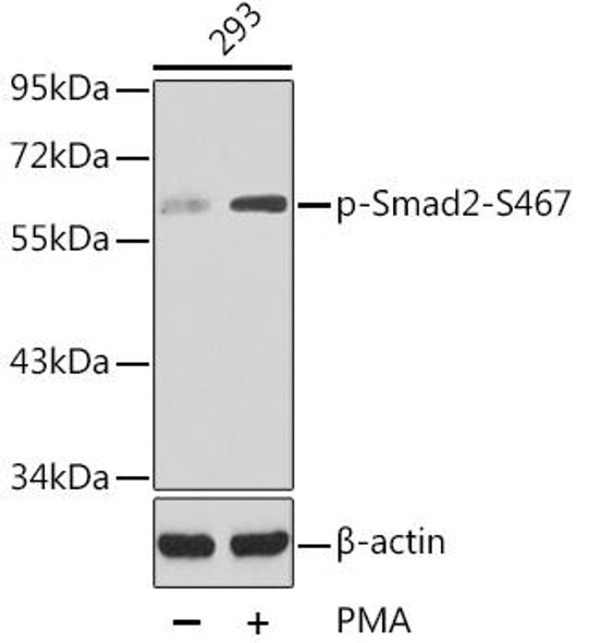 Anti-Phospho-SMAD2-S467 Antibody (CABP0269)