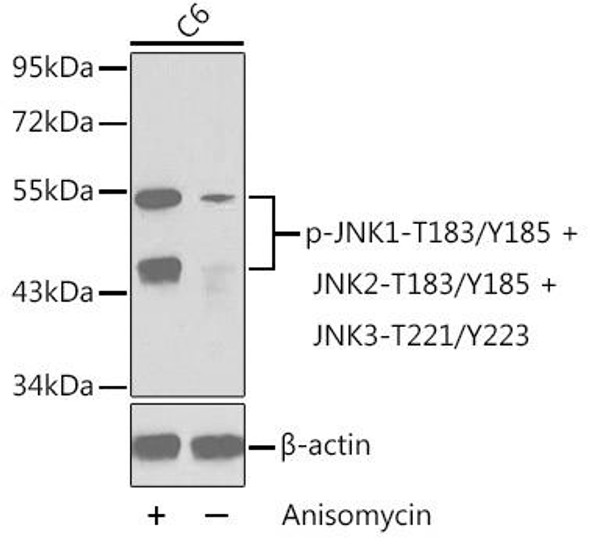 Anti-Phospho-MAPK8-T183/Y185 + MAPK9-T183/Y185 + MAPK10-T221/Y223 Antibody (CABP0276)