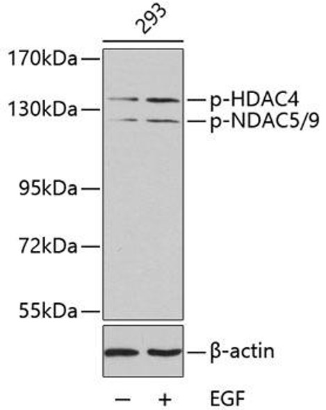 Anti-Phospho-HDAC4-S246/HDAC5-S259/HDAC9-S220 Antibody (CABP0280)