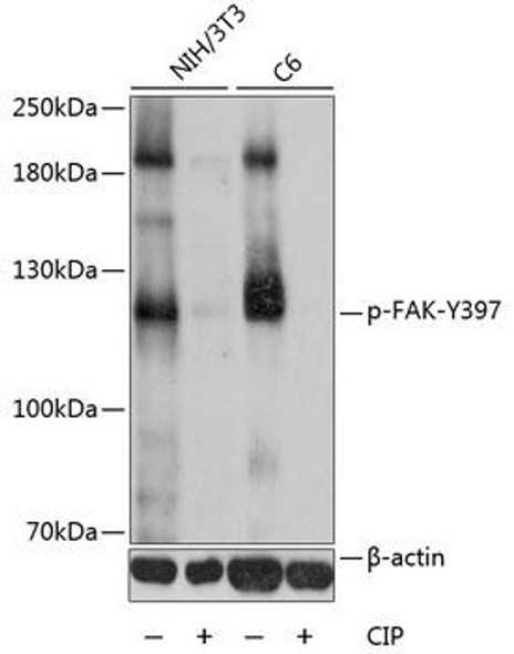 Anti-Phospho-PTK2-Y397 Antibody (CABP0302)