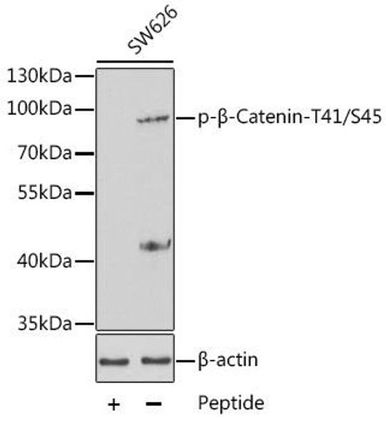 Anti-Phospho-Catenin beta-1-T41/S45 Antibody (CABP0336)