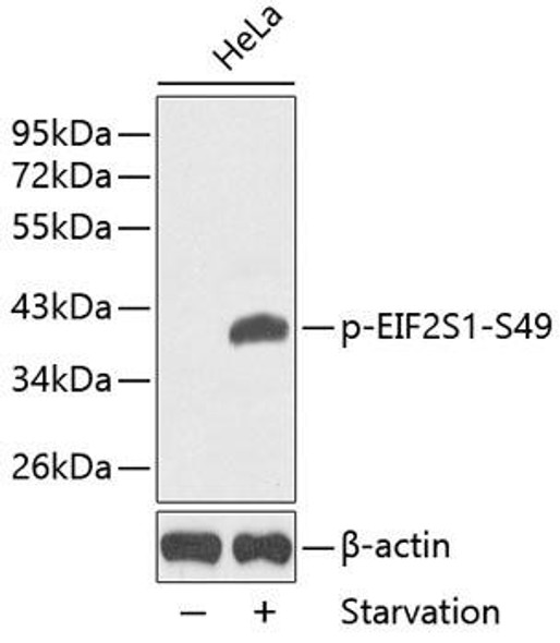 Anti-Phospho-eIF2a-S49 Antibody (CABP0341)