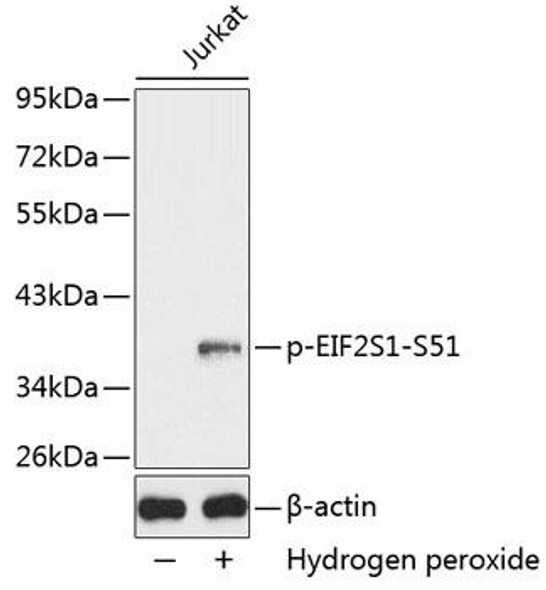 Anti-Phospho-eIF2a-S51 Antibody (CABP0342)