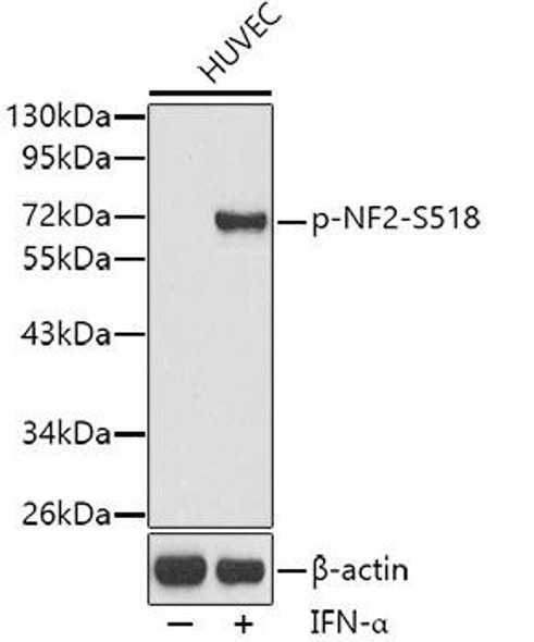 Anti-Phospho-Merlin-S518 Antibody (CABP0414)